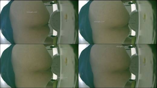 The thumbnail of Toilet_shooting_diarrhea_album_9_3